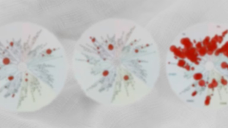 Stories from drug discovery: Dialing out off-target liabilities with protein residue mutation FEP+ in an active drug discovery project